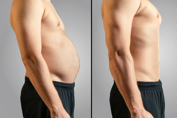 How to lose stomach fat quickly?